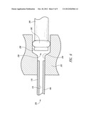 NEEDLE ARRAY ASSEMBLY AND METHOD FOR DELIVERING THERAPEUTIC AGENTS diagram and image