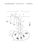 GUIDE-COMPATIBLE LARGE-ELECTRODE CATHETER FOR RENAL NERVE ABLATION WITH     REDUCED ARTERIAL INJURY diagram and image