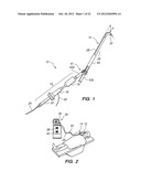 Endoscopic Methods and Devices for Transnasal Procedures diagram and image