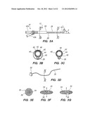 Endoscopic Methods and Devices for Transnasal Procedures diagram and image