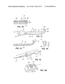 Endoscopic Methods and Devices for Transnasal Procedures diagram and image