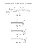 Endoscopic Methods and Devices for Transnasal Procedures diagram and image