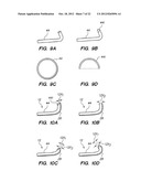 Endoscopic Methods and Devices for Transnasal Procedures diagram and image