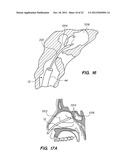 Endoscopic Methods and Devices for Transnasal Procedures diagram and image