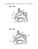 Endoscopic Methods and Devices for Transnasal Procedures diagram and image