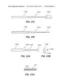 Endoscopic Methods and Devices for Transnasal Procedures diagram and image