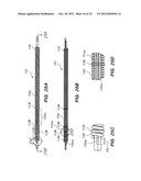 Endoscopic Methods and Devices for Transnasal Procedures diagram and image