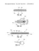 Endoscopic Methods and Devices for Transnasal Procedures diagram and image