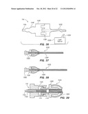 Endoscopic Methods and Devices for Transnasal Procedures diagram and image