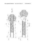 TOTAL CORE BIOPSY DEVICE AND METHOD OF USE diagram and image