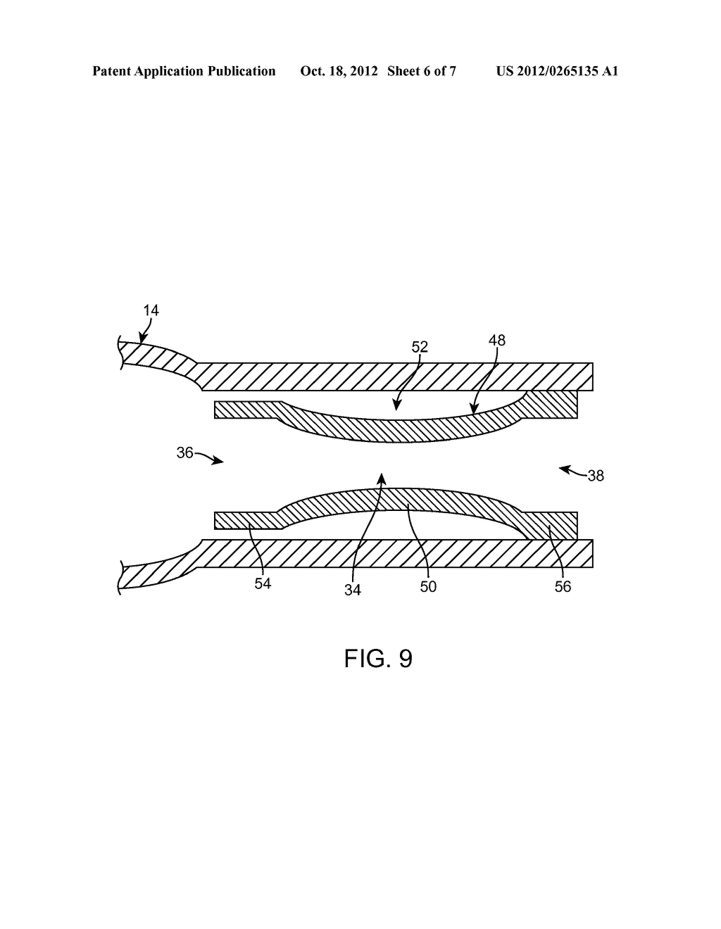 BALLOON CATHETER - diagram, schematic, and image 07