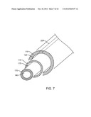 SYSTEMS AND METHODS FOR ENDOMETRIAL ABLATION diagram and image