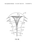 SYSTEMS AND METHODS FOR ENDOMETRIAL ABLATION diagram and image