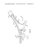 SYSTEMS AND METHODS FOR ENDOMETRIAL ABLATION diagram and image