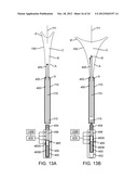 SYSTEMS AND METHODS FOR ENDOMETRIAL ABLATION diagram and image