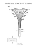 SYSTEMS AND METHODS FOR ENDOMETRIAL ABLATION diagram and image