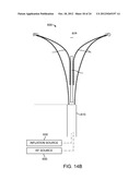 SYSTEMS AND METHODS FOR ENDOMETRIAL ABLATION diagram and image