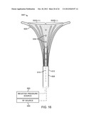 SYSTEMS AND METHODS FOR ENDOMETRIAL ABLATION diagram and image