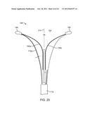 SYSTEMS AND METHODS FOR ENDOMETRIAL ABLATION diagram and image