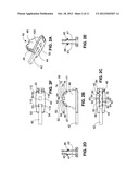 SURGICAL SAW DEVICE AND METHOD OF MANUFACTURE diagram and image