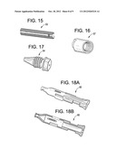 Vertebroplasty Curved Needle diagram and image