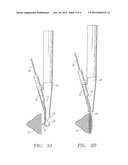 DIRECT ACCESS ATHERECTOMY DEVICES AND METHODS OF USE diagram and image