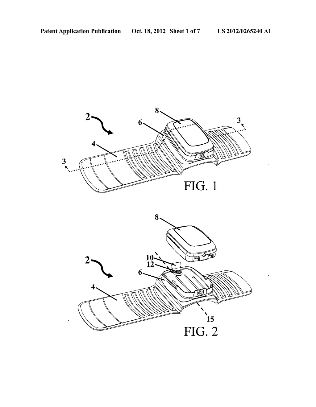 SYSTEM FOR PERFORMING REMOTE ISCHEMIC CONDITIONING - diagram, schematic, and image 02