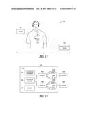 UNIDIRECTIONAL NEURAL STIMULATION SYSTEMS, DEVICES AND METHODS diagram and image