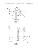 Implantable Intervertebral Fusion Device diagram and image