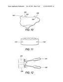 Implantable Intervertebral Fusion Device diagram and image