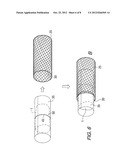 MEAT TRUSSING SYSTEM diagram and image