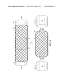 MEAT TRUSSING SYSTEM diagram and image