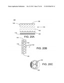 APPARATUS FOR PROVIDING PROTECTION FROM BALLISTIC ROUNDS, PROJECTILES,     FRAGMENTS AND EXPLOSIVES diagram and image