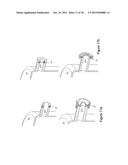 Gas concentrator with removable cartridge adsorbent beds diagram and image