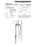 SYSTEM FOR TRANSTRACHEAL ADMINISTRATION OF OXYGEN diagram and image