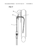 SYSTEM FOR TRANSTRACHEAL ADMINISTRATION OF OXYGEN diagram and image