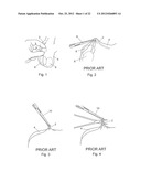 VASECTOMY DEVICES, KITS, AND METHODS OF USING SAME diagram and image