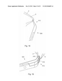 VASECTOMY DEVICES, KITS, AND METHODS OF USING SAME diagram and image