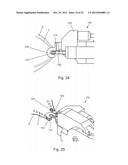 VASECTOMY DEVICES, KITS, AND METHODS OF USING SAME diagram and image