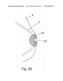 VASECTOMY DEVICES, KITS, AND METHODS OF USING SAME diagram and image