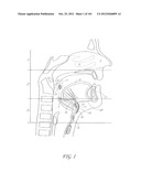 SYSTEM AND METHOD FOR PERCUTANEOUS PALATE REMODELING diagram and image