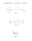 SYSTEM AND METHOD FOR PERCUTANEOUS PALATE REMODELING diagram and image