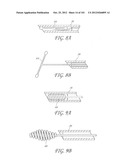 SYSTEM AND METHOD FOR PERCUTANEOUS PALATE REMODELING diagram and image