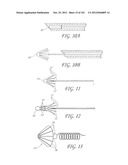 SYSTEM AND METHOD FOR PERCUTANEOUS PALATE REMODELING diagram and image