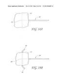 SYSTEM AND METHOD FOR PERCUTANEOUS PALATE REMODELING diagram and image