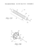 SYSTEM AND METHOD FOR PERCUTANEOUS PALATE REMODELING diagram and image