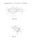 SYSTEM AND METHOD FOR PERCUTANEOUS PALATE REMODELING diagram and image