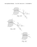 SYSTEM AND METHOD FOR PERCUTANEOUS PALATE REMODELING diagram and image