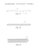 SYSTEM AND METHOD FOR PERCUTANEOUS PALATE REMODELING diagram and image