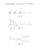 SYSTEM AND METHOD FOR PERCUTANEOUS PALATE REMODELING diagram and image